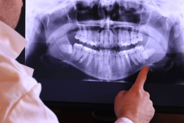 Best Urgent Care for Lost Fillings or Crowns in Watsontown, PA