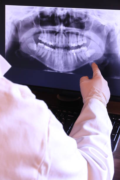 Best Emergency Gum Treatment in Watsontown, PA